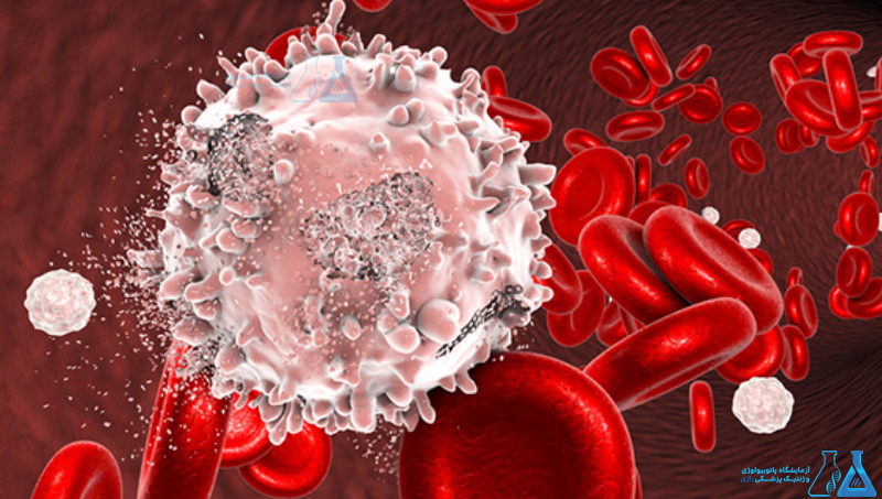 آزمایش Alpha -1 Antitrypsin